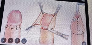 mayo clinic care network