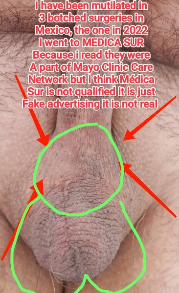 mayo clinic care network