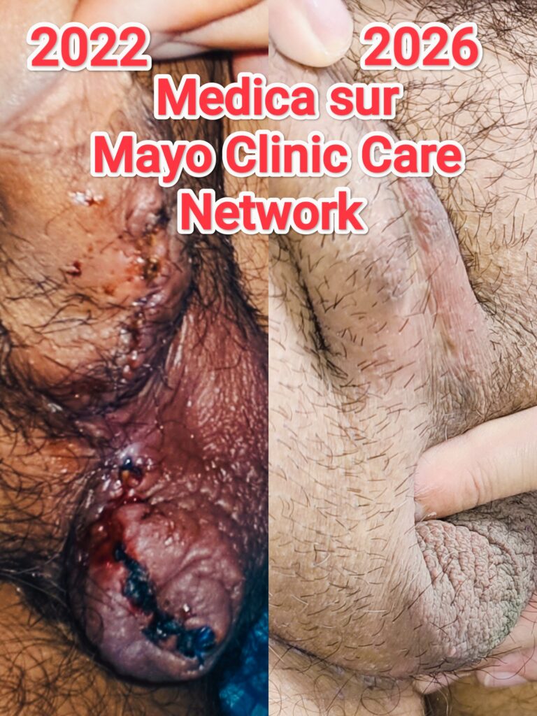 mayo clinic care network
