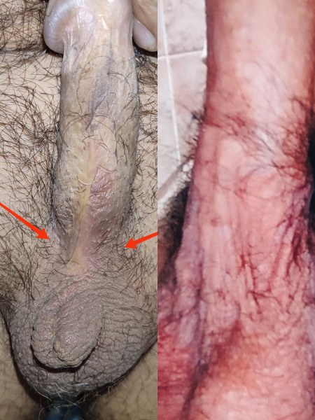 mayo clinic care network