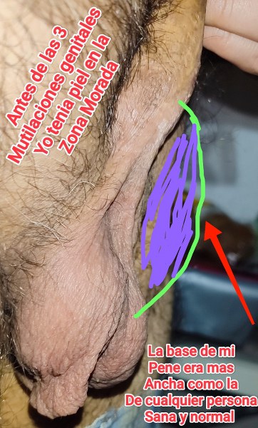 mayo clinic rochester