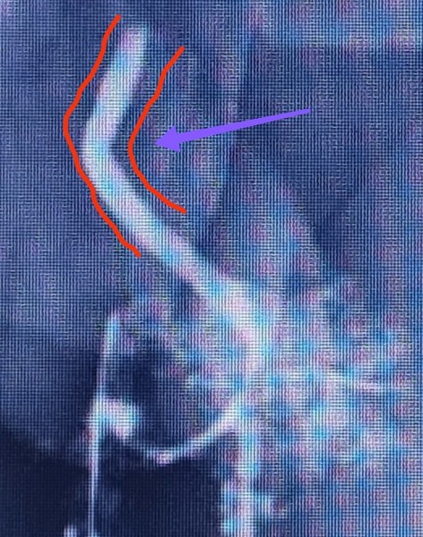 mayo clinic care network