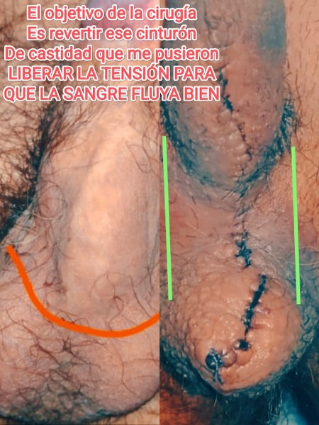 mayo clinic rochester